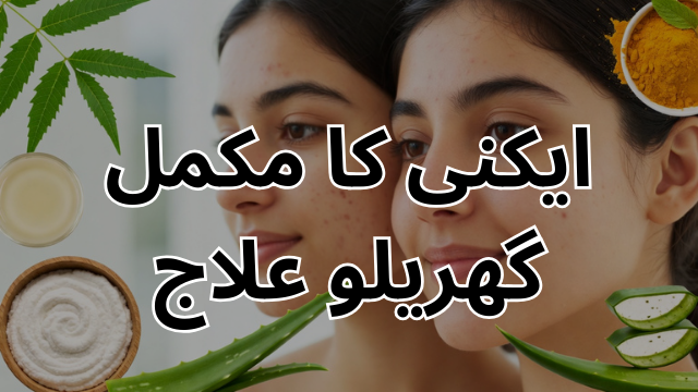 Acne treatment herbal